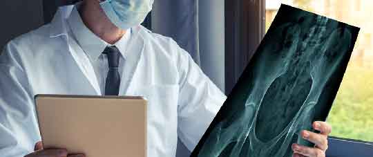 ORTHOPAEDICS ONCOLOGY